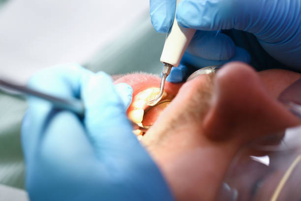 Best Emergency Cosmetic Dentistry (e.g., broken veneers) in Atlantic, IA