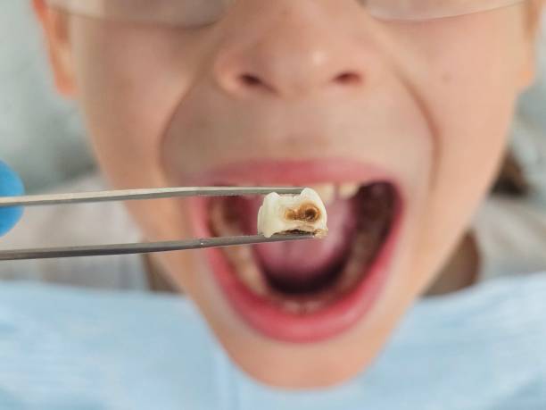 Best Emergency Care for Gum Disease in Atlantic, IA